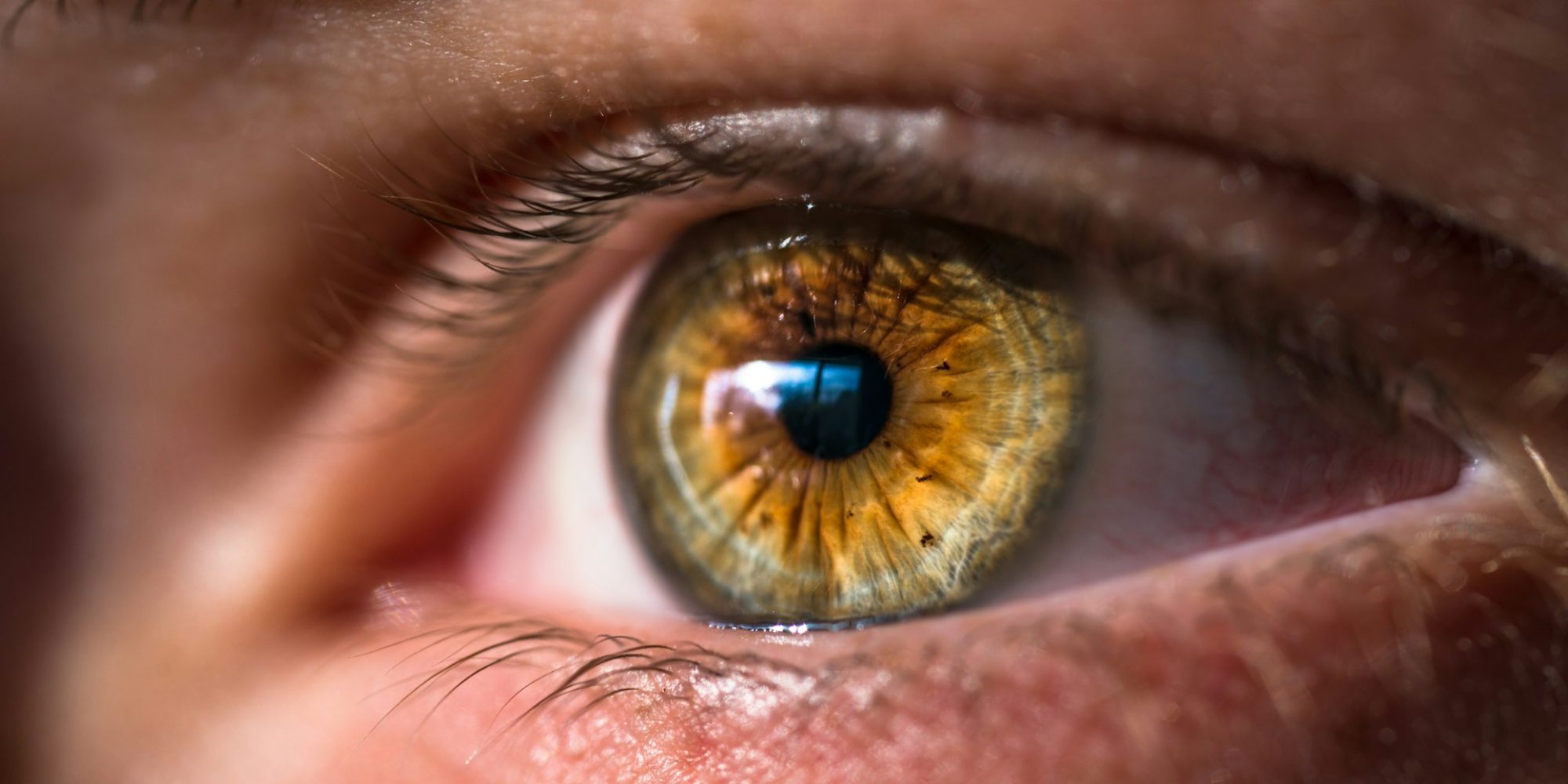 faticue oculaire symptomes